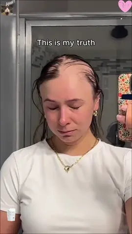 If your brush is full of hair every day — this is your sign. 💥This shampoo promotes new growth and blocks hair loss.And yeah… it’s BOGO right now 👀 #HairCareTips #GrowYourHair #HairLossHelp #BuyOneGetOne #TikTokDeals