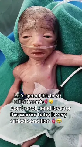 #nicubaby #weakbaby #NICULiferepoet #usa🇺🇸 #uk 