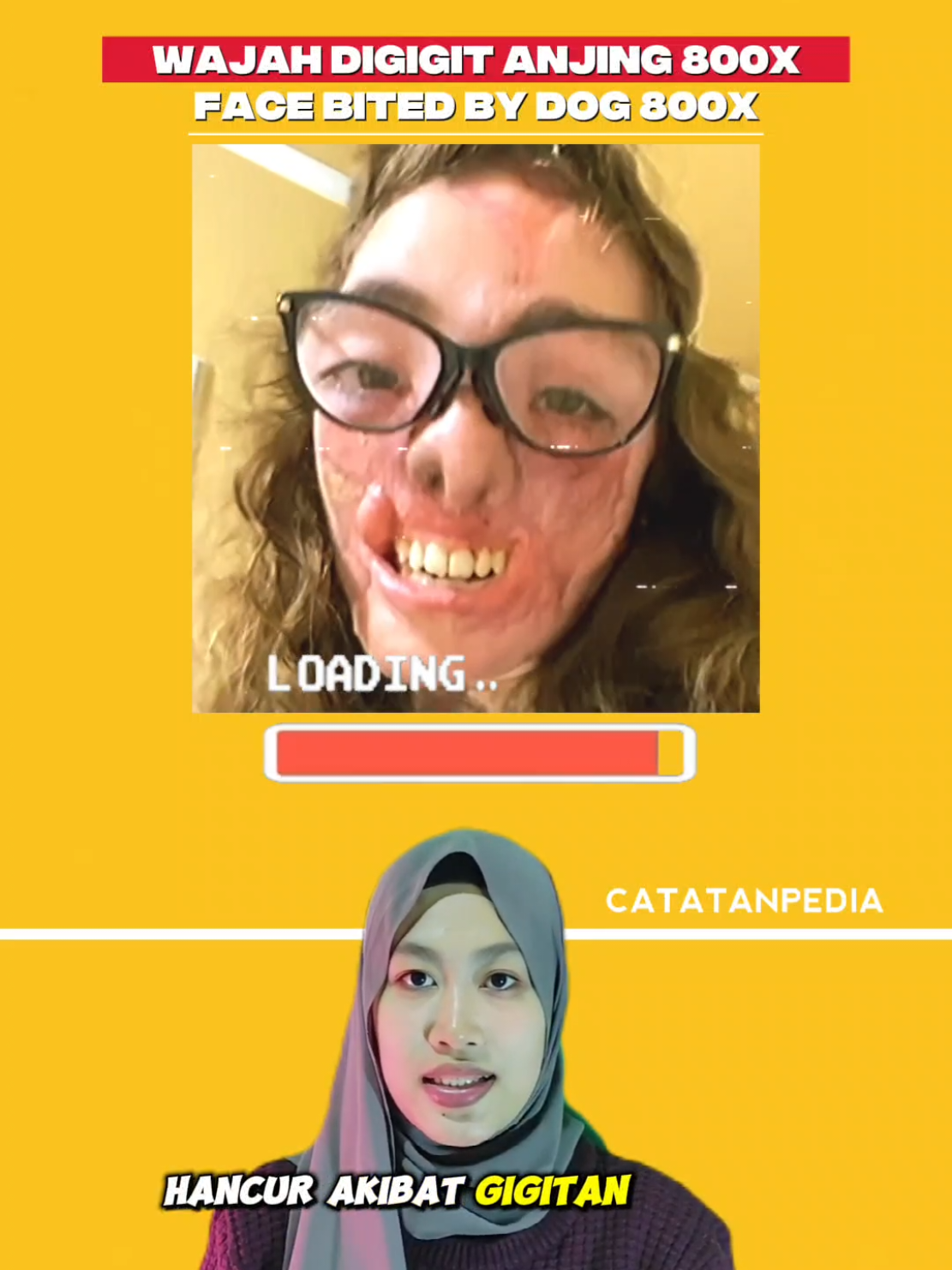 Beruntung! Bertahan Hidup Setelah Digigit Anjing Sebanyak 800x