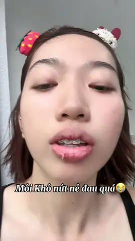 Ai bị giống em không😢#fyp #xuhuong #làmđẹp #lamdepkhongkho #viral 