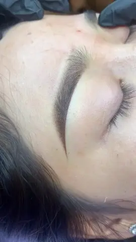 #Phunxamthammy   #hairstrokes#lamdeptainha #thammycongnghecao #xoaxamlaser 