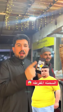 السمنه المفرطه 😱 #فراس_الحمادي 