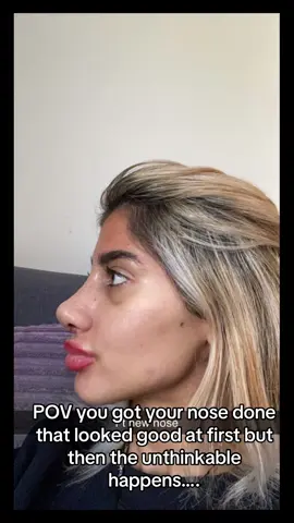 Safe to say the UK are only good for meal deals #fyp #surgery #nosejob 