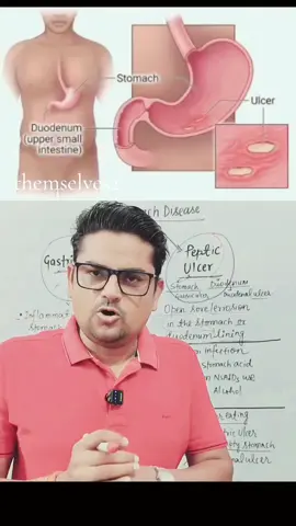 Stomach Disease.@The Medlover's #LIVEIncentiveProgram #LIVEwithlowfollowers #PaidPartnership 