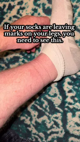 #diabeticsocks #socks #compressionsocks #SelfCare #healthylifestyle @Araam Collection 