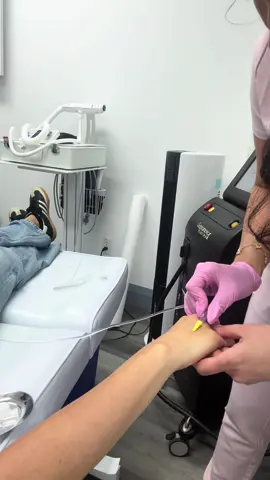 Thinking about IV therapy but too afraid of the needle? ✨ You’re not alone! So many people want the benefits (hydration, vitamins, glowing skin 💧✨) but get nervous about “the poke.” That’s why technique matters. I make IV starts quick, smooth, and as comfortable as possible, so you can relax and enjoy all the benefits without the stress. 💛 #ivtherapy #ivdrip #hydrationtherapy #nurseinjector #aestheticnurse #torontonurse #beautybynurse #ivvitamins #wellnessfromwithin #needleanxiety #ivwellness #wellness #nurseinjector 