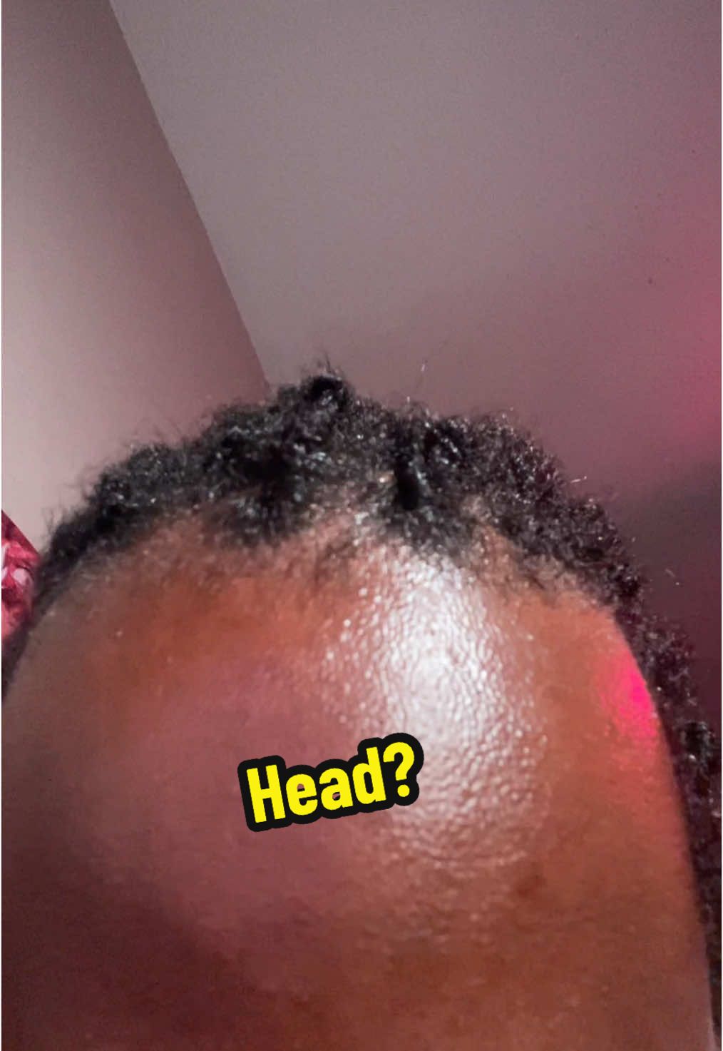 head? #retwistlocs #forehead #fypシ 