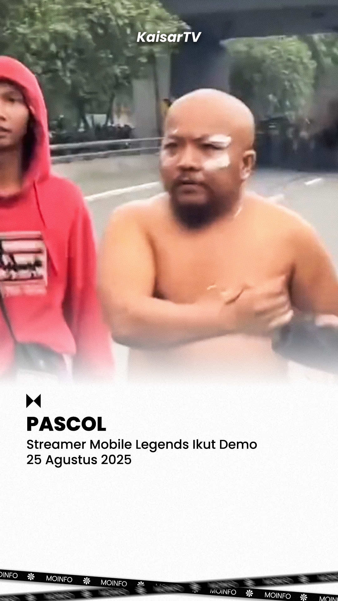 Pascol nama asli Dana Panjaitan, streamer asal Medan kelahiran 1995 terlihat ikut aksi demo di depan Gedung DPR RI, Senin (25/8/2025). Ia maju di barisan depan dengan penampilan khasnya: kolor putih yang biasa ia kenakan saat live streaming. Bahkan, Pascol sempat mengoleskan pasta gigi di bawah mata untuk mengurangi efek gas air mata. Gimana menurut kalian? #demo #demodpr #demodpr25agustus