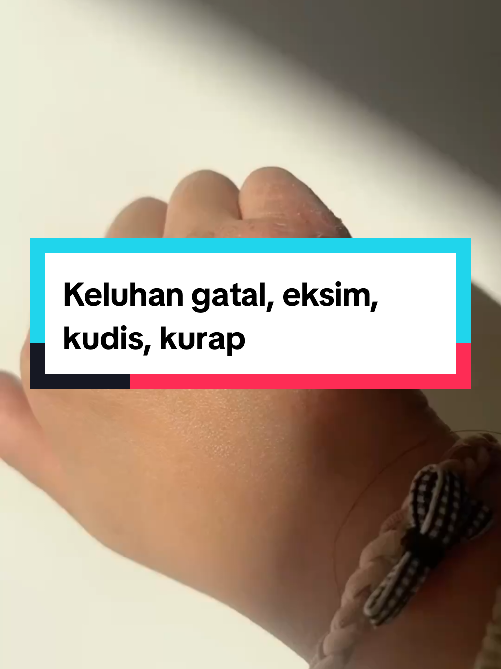 Keluhan gatal, eksim, kudis, kurap.  #gatalgatal #eksim #kudis #kurap #salepracikan 