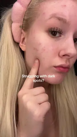 This Jumiso dark spot serum is my new go to for dark spots😍 #jumiso #kderma #niacinamide #darkspotremover #skintransformation @Jumiso Official 