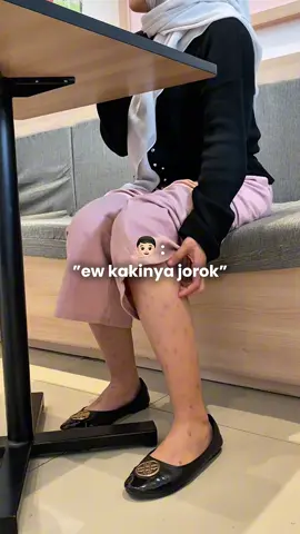 gamau gini lagi🥺 #fyp #trending #bekasluka #darahmanis #korengan #mulus #viral #dsaviorofficial #foryou #fypシ゚viral #putihbersihglowing #glowing #bodycare 