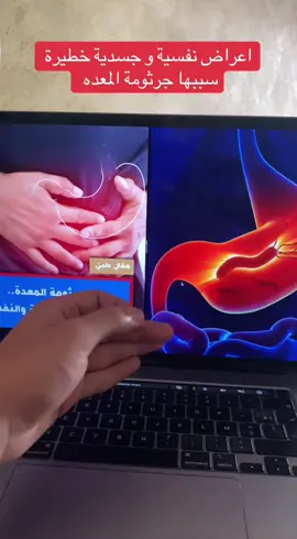 #سِيبُو #صحة_الجهاز_الهضمي #انتفاخ_البطن #بكتيريا_الأمعاء #بكتيريا_الأمعاء #السعودية #السعوديه #الشعب_الصيني_ماله_حل😂😂 #الشعب_الصيني_ماله_حل #اكسبلوررررر #حموضة_المعدة #ارتجاع_المرئ #القولون_العصبي #شوك_الجمل #الكبد_الدهني #باطنية #احتباس_السوائل_بالجسم #هضم_صحي #صحة_الجسم #السعودية🇸🇦 #نصائح_صحية 