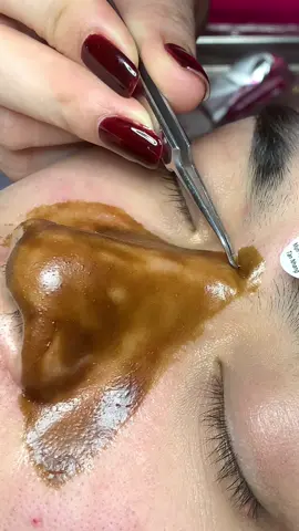 Ổn  #chamsocdaseo#chamsocda#chamsocdamun#chamsocdanam#tanbinh      