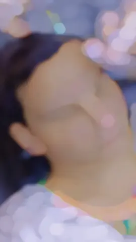 PRP #prphairrestoration #hair #prp #exosome #fyp 