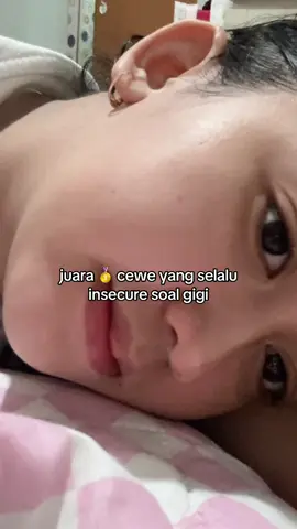pliss lemah bgt klo soal gigi:(#capekgakfyp #gigi #insecure 