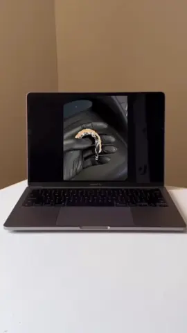 #allon4 #allon6 #moldova #виниры 