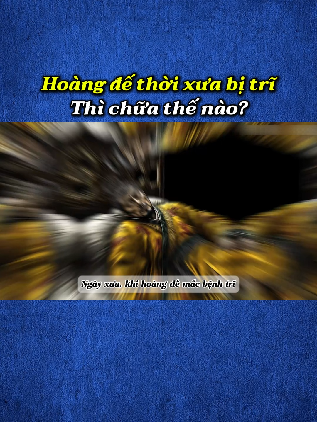 Hoàng đế thời xưa bị trĩ thì chữa thế nào?#truyenngan #kểtruyệnnhậpvai #truyenhay #doctruyen #hoangdenoikinh