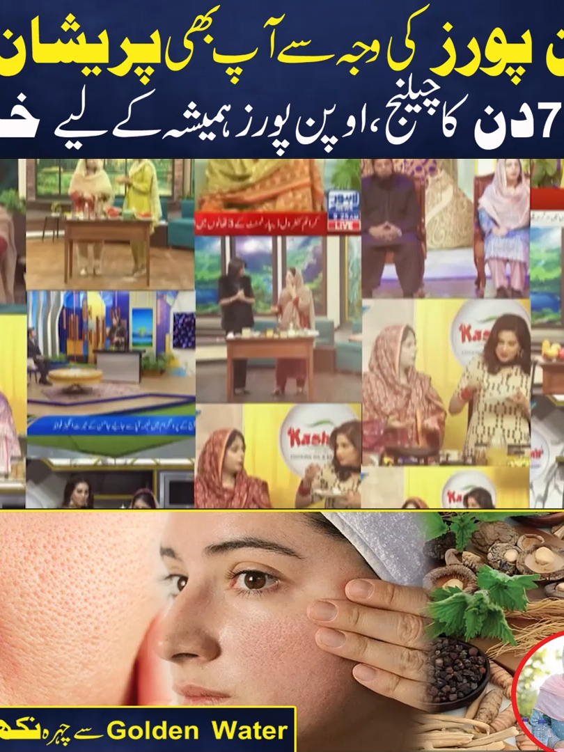 اوپن پورز کی وجہ سے آپ پریشان ہیں؟ صرف سات دن کا چیلنج، اوپن پورز ہمیشہ کے لیے ختم! #skincare #openpores #goldenwater #naturalremedies #naimaapa #glowingskin #healthyskin #homeremedy #beautytips #closeopenpores #acnecare #oilysskin #porecare #flawlessskin #herbalremedy #diybeautytips #clearskin #blackheadremoval #antiagingtips #naturalskincare