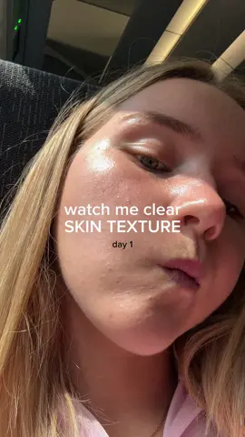 HOW TO CLEAR TEXTURE ⬇️ Step 1 – Unclog your pores🫧 Texture often starts when pores get blocked. Use ingredients like salicylic acid because they clean your pores from the inside out (removing excess oil + dead skin).  Usage: 1–2x a week if you’re new, 2-3x if your skin tolerates it. Step 2 – Start a retinoid🧴 Retinoids increase cell turnover, which clears texture, and prevents new bumps from forming. It’s my top ingredient for texture. Step 3 – Remove pore-cloggers People with acne-prone skin usually have “hyper retention keratosis” (pores are extra prone to getting clogged), so it’s super helpful to avoid cloggers. They’re often the culprit of texture! Step 4 – Be consistent Texture doesn’t change overnight - you may have to experience a purge to clear out your skin, but IT IS WORTH IT I PROMISE. Stick with it 💞 #lifewithmils #skincaretips #retinoid #salicylicacid #clearskin