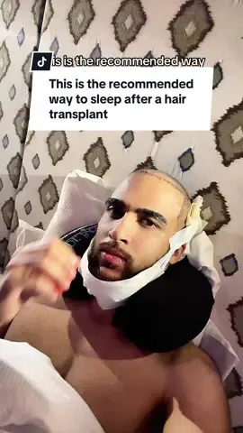 This is the recommended way to sleep after a hair transplant #hairtransplantrepair #hairreconstruction #hairtransplantturkey #hairtransplantsurgery #hairtransplantistanbul 