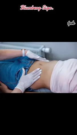 Blumberg's sign, also known as rebound tenderness, is a clinical sign indicating peritonitis, or inflammation of the peritoneum (the lining of the abdominal cavity), where pain is felt more acutely when pressure is rapidly released from the abdomen than when it is applied. To elicit it, a healthcare provider slowly applies deep pressure to a tender area of the abdomen and then suddenly releases it, a maneuver that causes increased pain upon withdrawal.