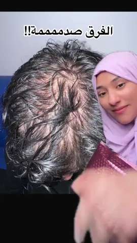 قبل وبعد نتيجة سيروم الشعر من ماي بيوتي😍 #ماي_بيوتي #my_beauty 