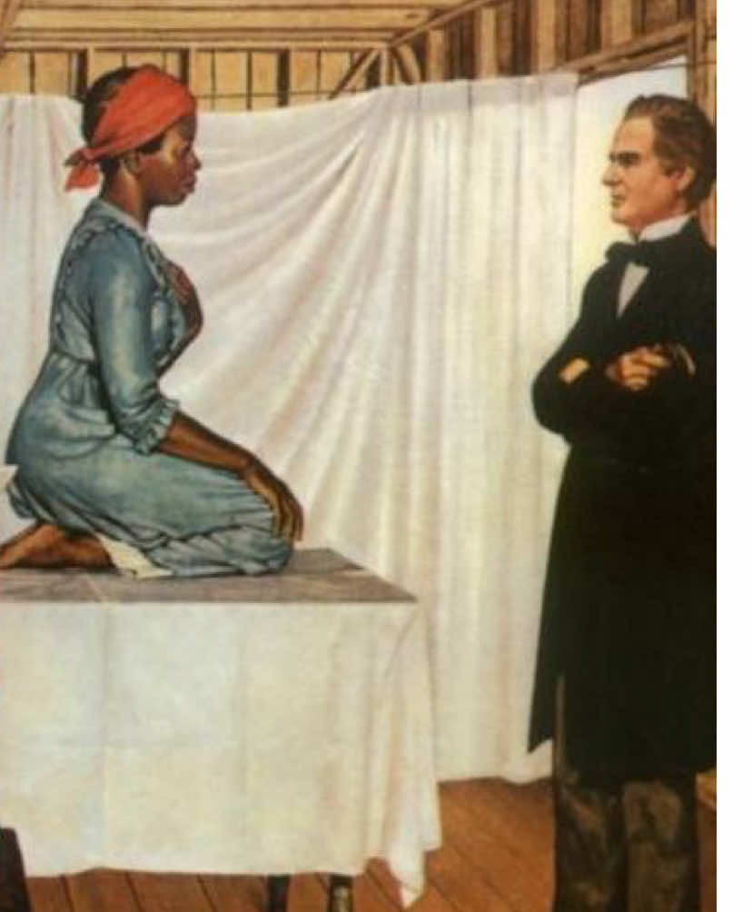 “Você conhece o espéculo vaginal? Ele foi criado às custas do sofrimento de mulheres negras.” #fyyyy #forypupage #viral #perolasdaescravidao #cobaias 