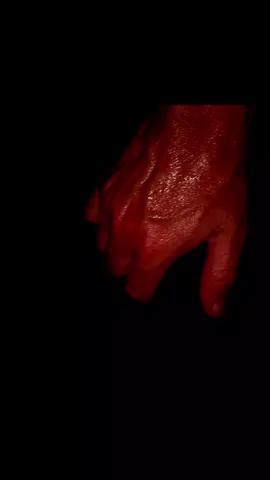 #veinyhands #veinyhand #handtrend #handtrends #mrveins2000 