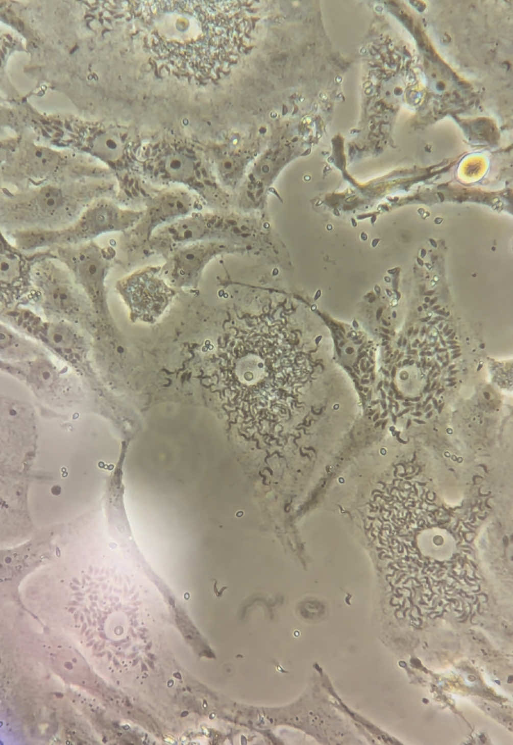 Tão bonitinho, nem parece que mata a gente😊🔬 #laboratorio #biologia #cientista #microscope 