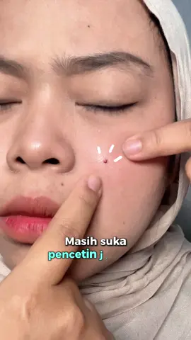 Jangan lagi yaaa pencetin jerawat!! #DermaAngel #acnepatch #jerawat 