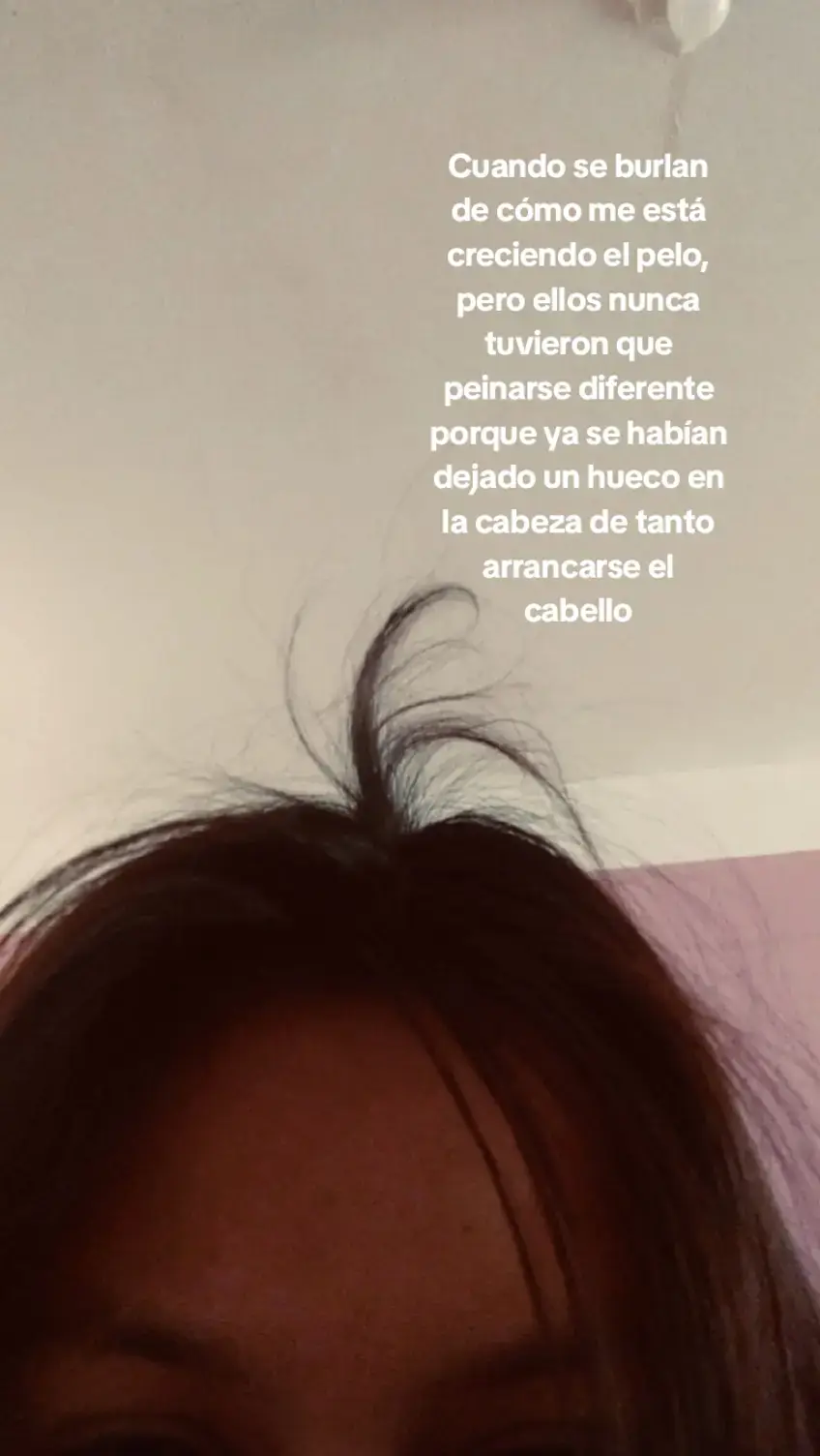 #tricotilomania #girls #fyp #contenido #fypp 