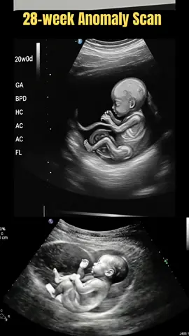 28 weeks baby ultrasound Scan #fylpシviralシ #pregnancy #babydevelopment #pregnancyjourney #ultrasound 