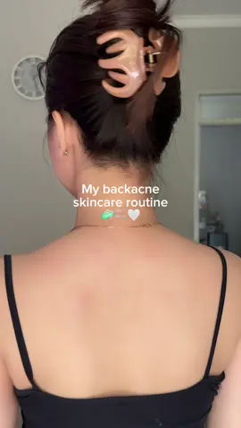 my backacne skincare routine✨💚 #acnebaracnaway