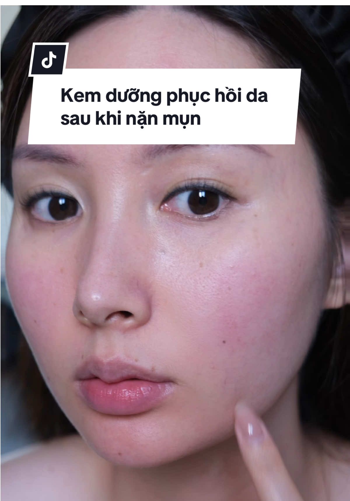 Sau khi nặn mụn về tui dùng mỗi em này để phục hồi da thôi á. #caryophy #caryophyvietnam 