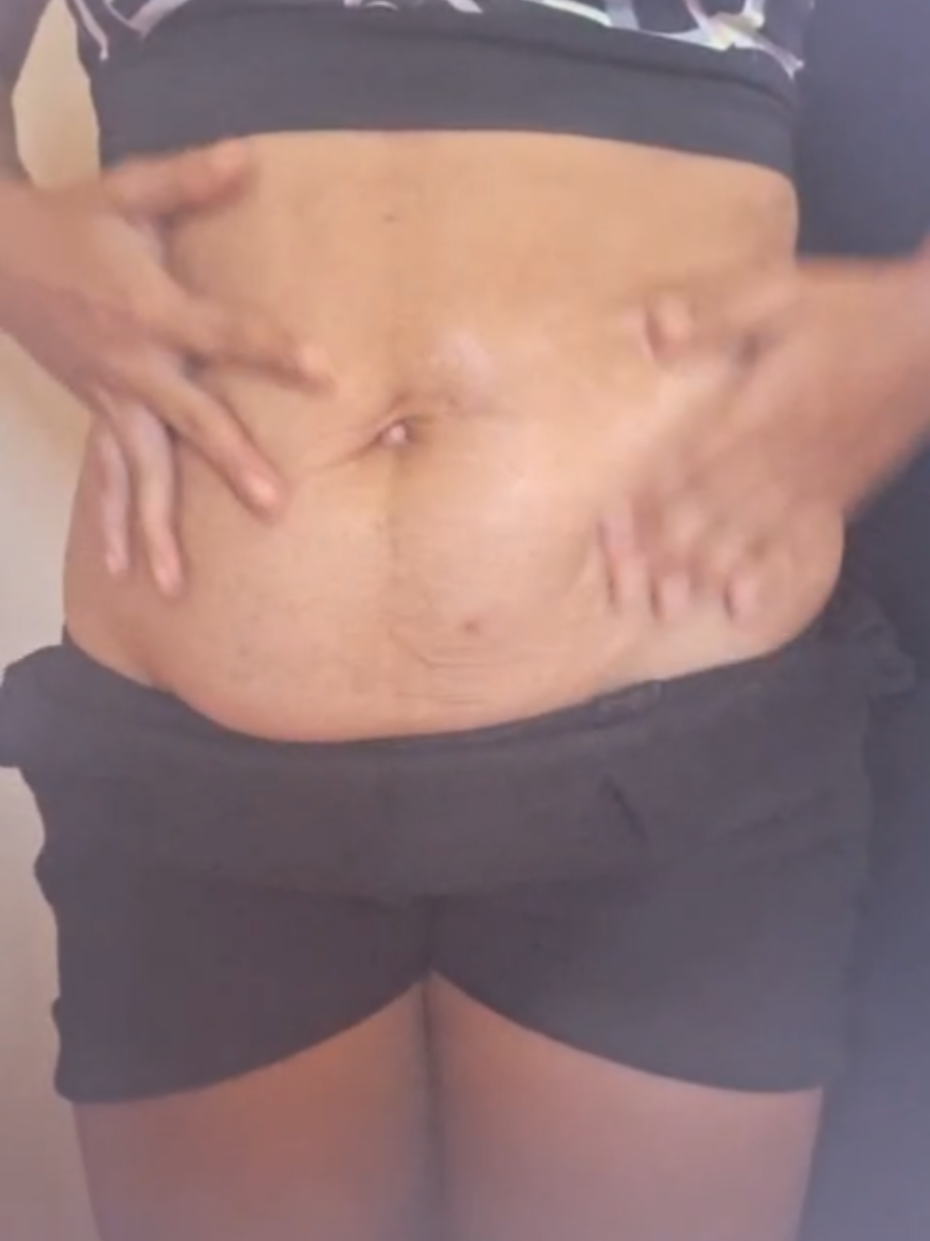 só quem passou pela a gestação sabe o quanto a nossa autoestima fica baixa mas o centella asiatico veio pra nós ajudar e devolver a nossa segurança e autoestima 🥰✨ #MinhaRotinaReal #comoeliminarmanchas  #barrigainchada #estriasbrancas 