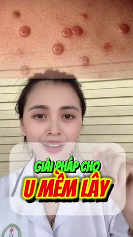 Giải pháp hỗ trợ cải thiện u mềm lây an toàn và h.iệu quả #umemlay #MCV #dstrinhgiang #ntnamkhang 