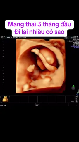 Mang thai 3 tháng đầu, đi lại nhiều có sao?#xuhuong #vairal #fyp 