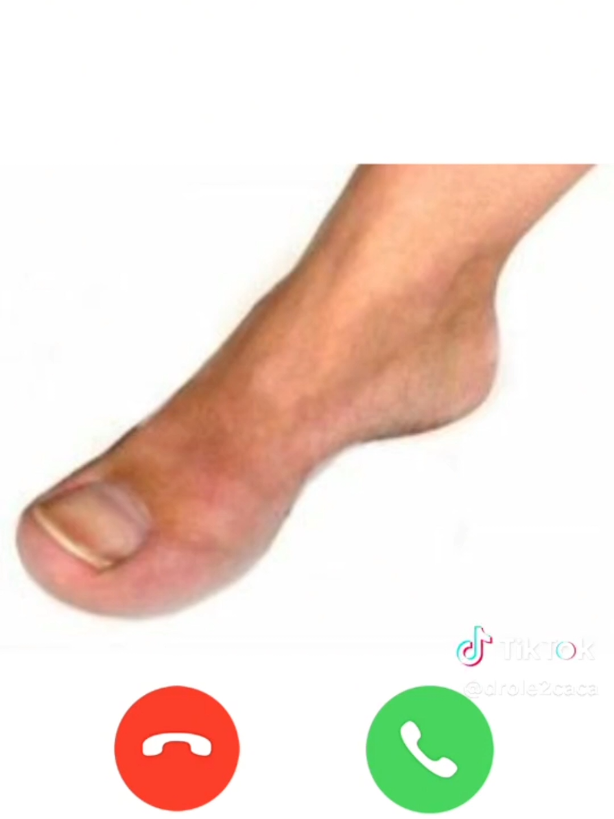 @gingko #2010 #umboxing #fyp #brainrot #CapCut 