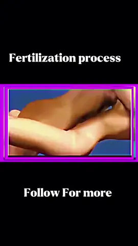 Fertilization process #fertilityjourney #unfreezemyacount #fertilityjourney 