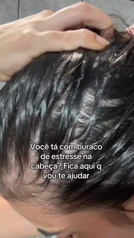 A solução que consegui pra tampar meus buracos de estresse amg #alopecia #fyp 