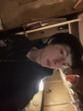 Braces hurt 💔 #fyp #piercings  ##wlw