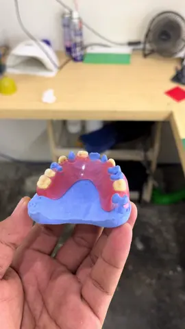 Flexible Denture #gigipalsulepaspasang #gigipalsuvalplas #dentallaboratory #dentallab #pengikut 