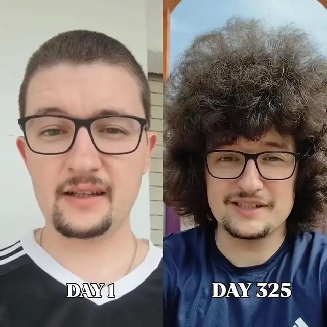 This Manchester United fan pledged not to cut his hair until the team wins five games in a row, with his last haircut happening on October 5, 2024.