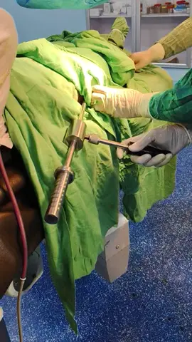 اگر کسی کے جسم میں دو سال سے زیادہ راڈ ڈلا ہو تو اس کو نکلوا دینا چاہیے ۔عمر کے حساب سے #shorts #viral #foryou #orthopedicsurgeon #femurfracture 