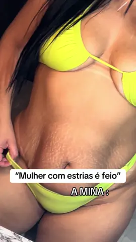 #estrias #estriasbrancas #flacidez #barriga #amorproprio 