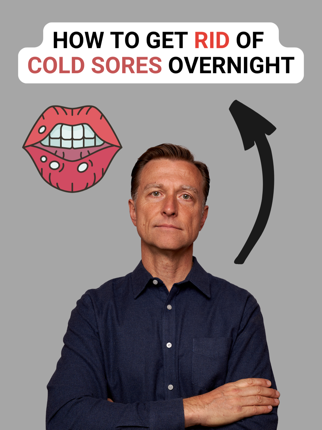 This is how to get rid of cold sores FAST! #drericberg #coldsore #healthtips #health
