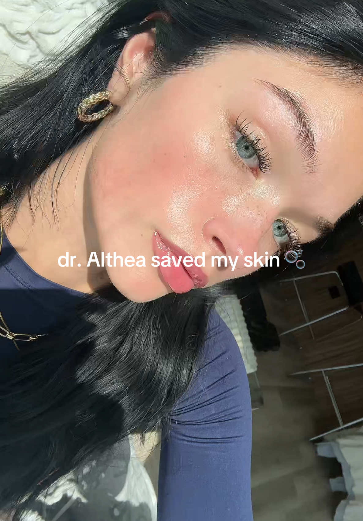 And it did work 💅🏼💅🏼💕 @Dr.Althea US #sensitiveskin #dralthea #skin 