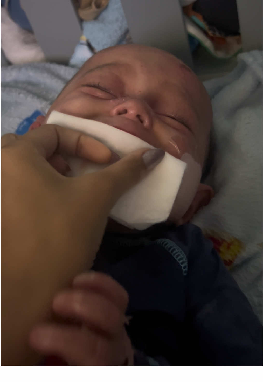 Parte o meu coração. (Epidermólise bolhosa)#maesolo #doencacronica #fyppppppppppppppppppppppp #fy 