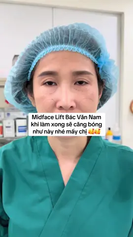 Midface Lift mới làm xong phải sưng mới hiệu quả lâu dài #nguyenvannam #bsvannam #midfacelift #nangtangmatgiua #midface 