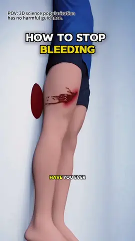How To Stop Bleeding In Emergency 🩸| Life Saving Device 3D Animation #emergency #firstaid #bloodstop #howtostopbleeding #bleeding #emergencyfirstaid #firstaidtraining #firstaidskill #firstaidskills #firstaidtips #medical3danimation #3dmedicalanimation #bleedingstopped #injuryrecovery